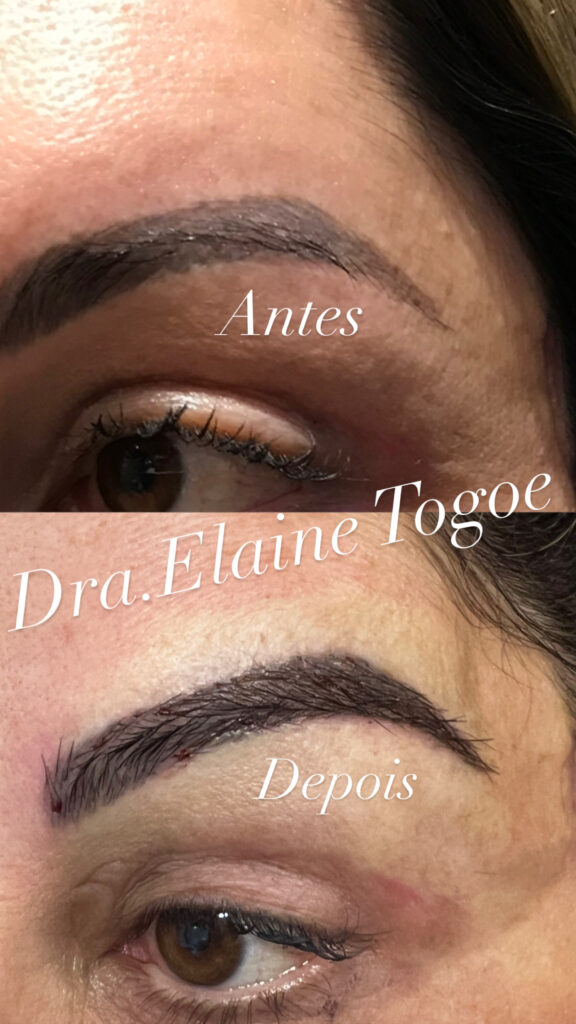 B054152E-3308-459A-B9F7-087C041C9055