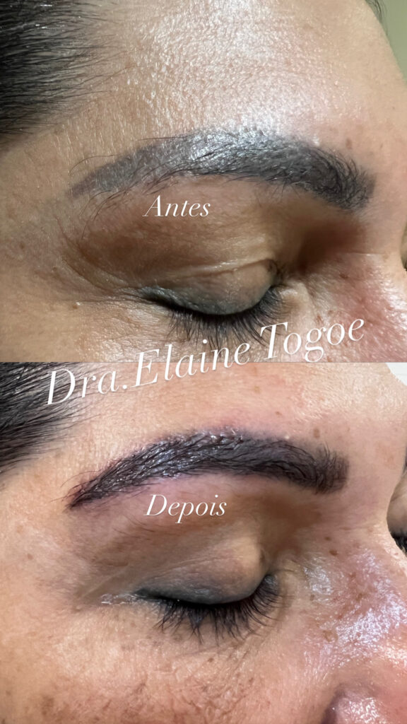 CA2CA8C1-13C2-4E0C-9018-600BAF465AE8